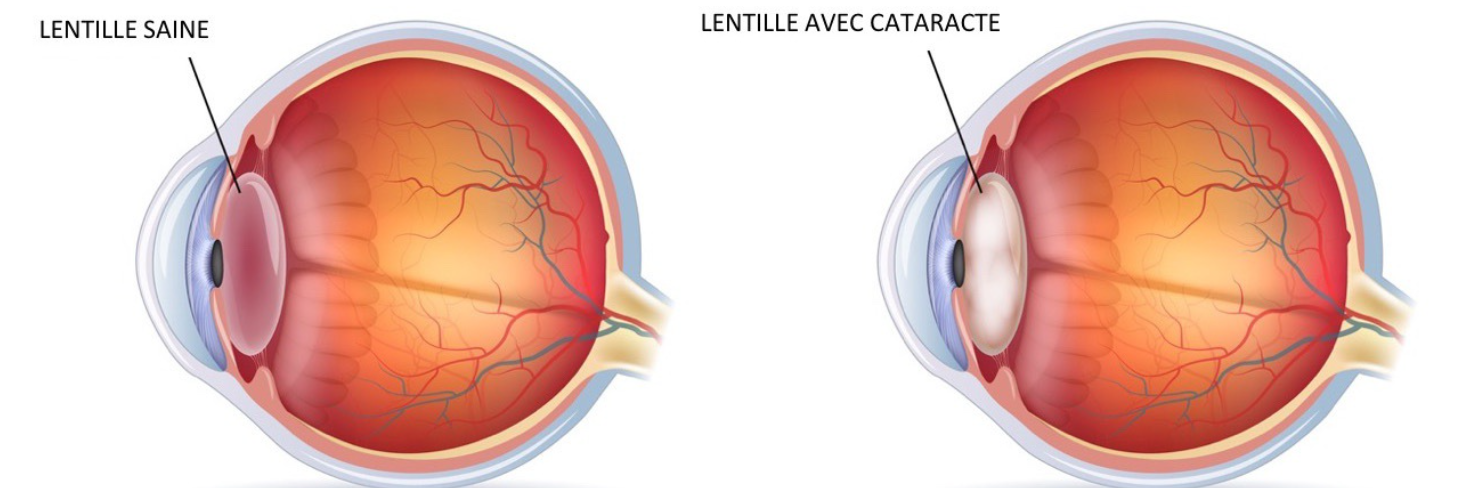 Capture d'écran 2025-07-29 165646
